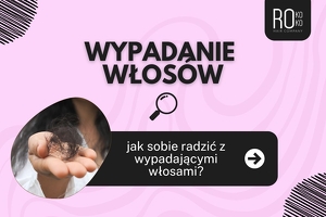 Co na wypadanie włosów? Skuteczne sposoby na nadmierne wypadanie