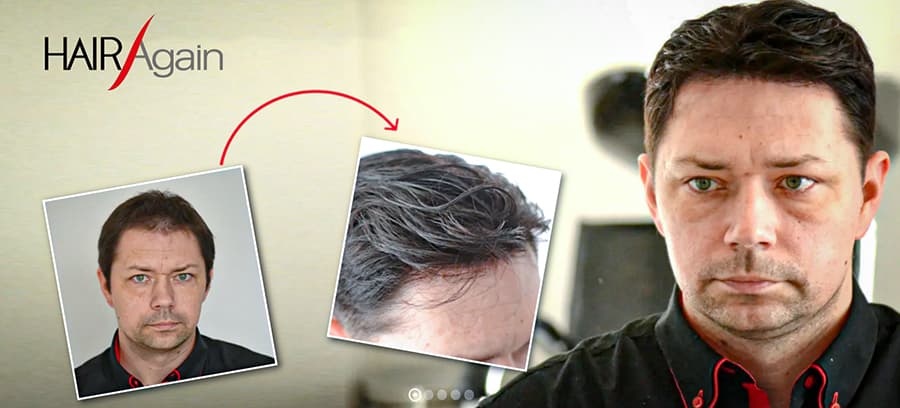 system włosów HairAgain